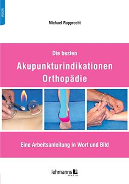 Die besten Akupunkturindikationen Orthopädie: Eine Arbeitsanleitung in Wort und Bild