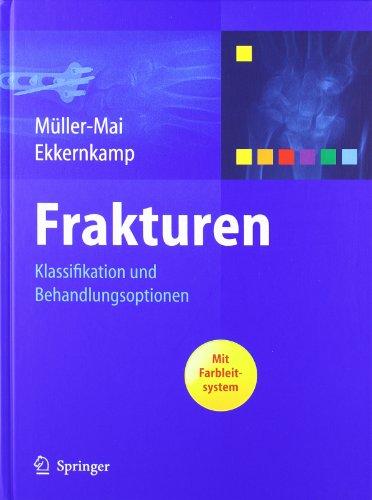 Frakturen: Klassifikation und Behandlungsoptionen