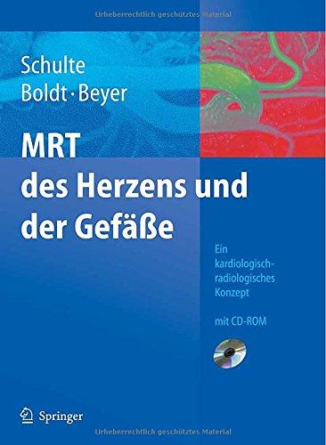 MRT des Herzens und der Gefäße: Indikationen - Strategien - Abläufe - Ergebnisse: Indikationen - Strategien - Ablaufe - Ergebnisse