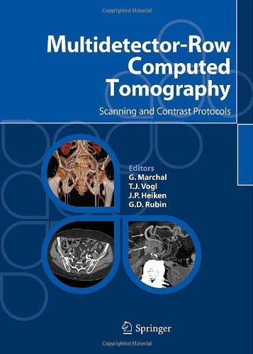 Multidetector-Row Computed Tomography: Scanning and Contrast Protocols