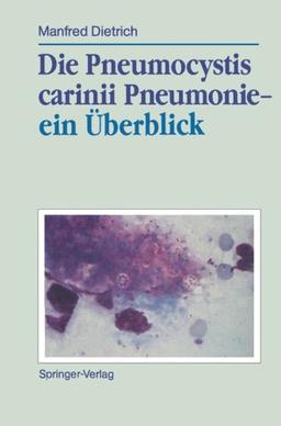 Die Pneumocystis carinii Pneumonie- ein Überblick