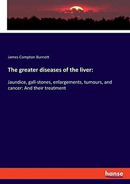 The greater diseases of the liver:: Jaundice, gall-stones, enlargements, tumours, and cancer: And their treatment