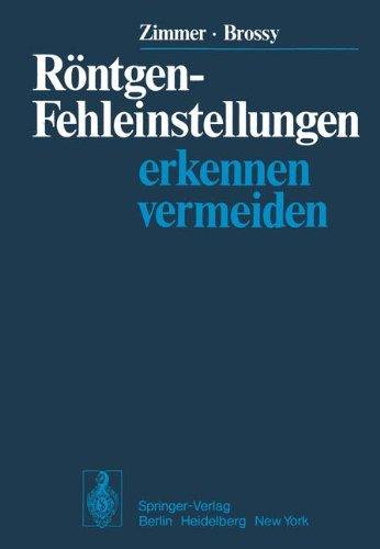 Röntgen-Fehleinstellungen: Erkennen und vermeiden