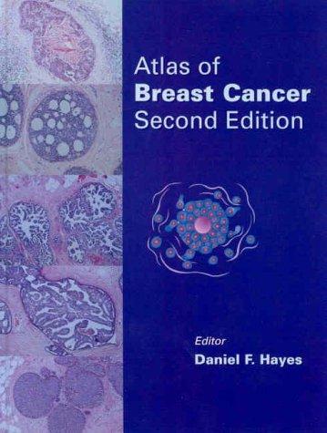 Atlas of Breast Cancer