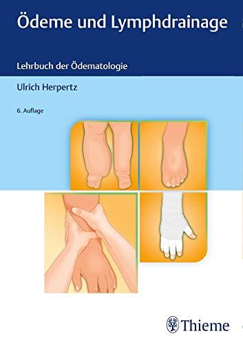 Ödeme und Lymphdrainage: Diagnose und Therapie