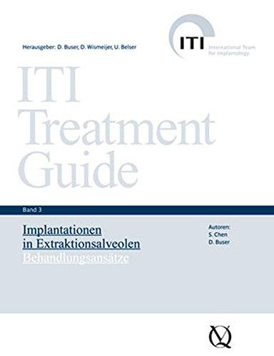 ITI Treatment Guide Band 3: Implantationen in Extraktionsalveolen