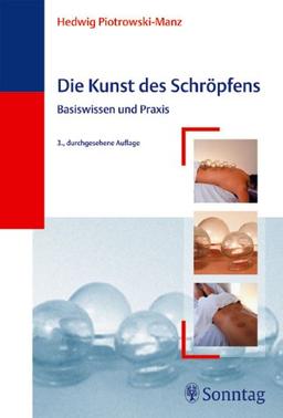 Die Kunst des Schröpfens. Basiswissen und Praxis