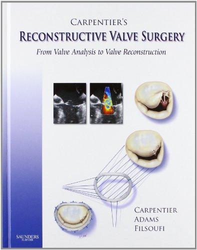 Carpentier's Reconstructive Valve Surgery