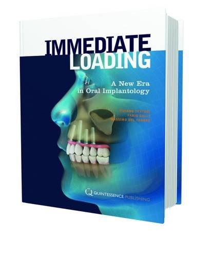 Immediate Loading: A New Era in Oral Implantology