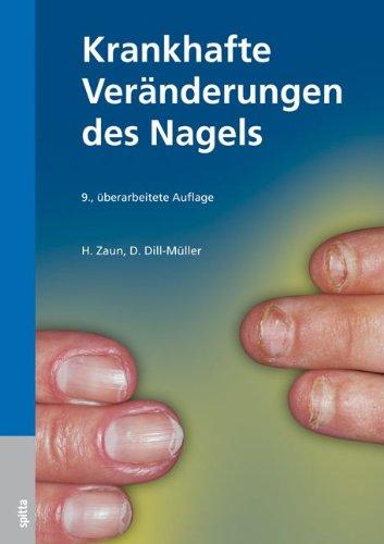 Krankhafte Veränderungen des Nagels