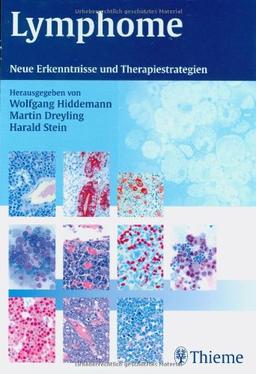 Lymphome: Neue Erkenntnisse und Therapiestrategien