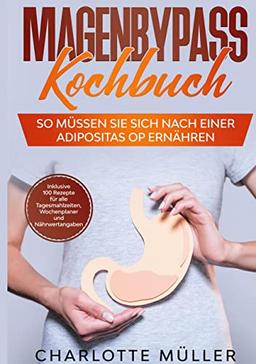 Magenbypass Kochbuch: So müssen Sie sich nach einer Adipositas OP ernähren - Inklusive 100 Rezepte für alle Tagesmahlzeiten, Wochenplaner und Nährwertangaben