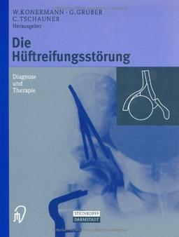 Die Hüftreifungsstörung. Diagnose und Therapie