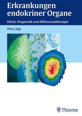 Erkrankungen endokriner Organe