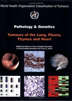 Pathology and Genetics of Tumours of the Lung Pleura Thymus and Heart (IARC WHO Classification of Tumours)