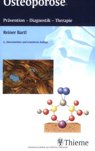 Osteoporose. Prävention, Diagnostik, Therapie