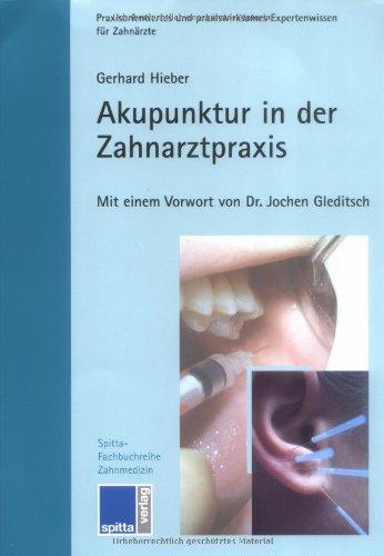 Akupunktur in der Zahnarztpraxis