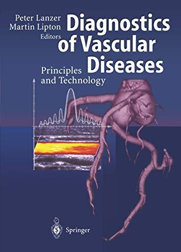 Diagnostics of Vascular Diseases: Principles and Technology