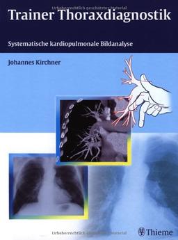 Trainer Thoraxdiagnoistik: Systematische kardiopulmonale Bildanalyse