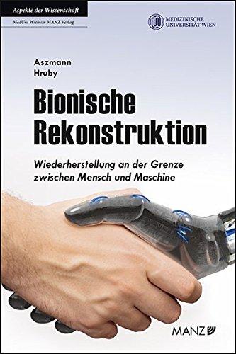 Bionische Rekonstruktion: Wiederherstellung an der Grenze zwischen Mensch und Maschine (MedUni Ratgeber)