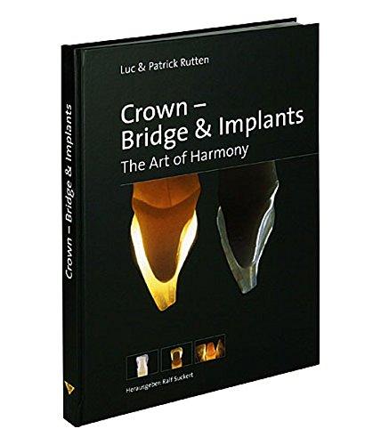 Crown - Bridge & Implants. The Art of Harmony