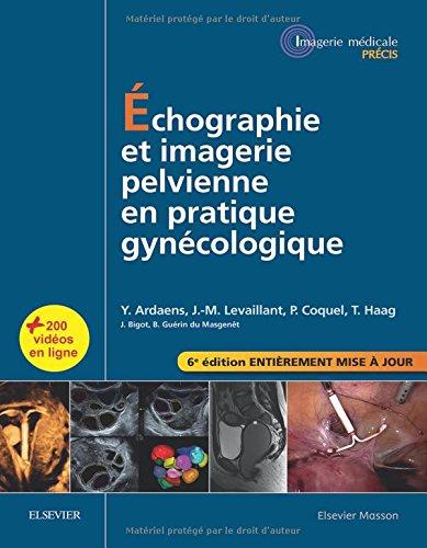 Echographie et imagerie pelvienne en pratique gynécologique