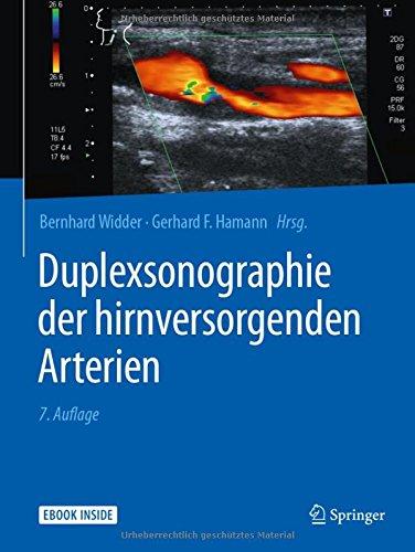 Duplexsonographie der hirnversorgenden Arterien