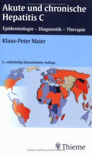 Akute und chronische Hepatitis C: Epidemiologie, Diagnostik, Therapie