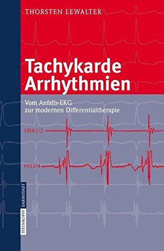 Tachykarde Arrhythmien: Vom Anfalls-EKG zur modernen Differentialtherapie: Vom Anfalls-Ekg Zur Modernen Differenzialtherapie